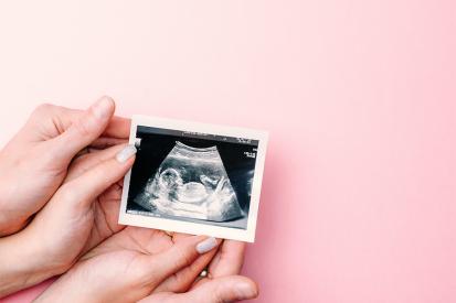 Two pairs of hands holding an ultrasound photo of a baby