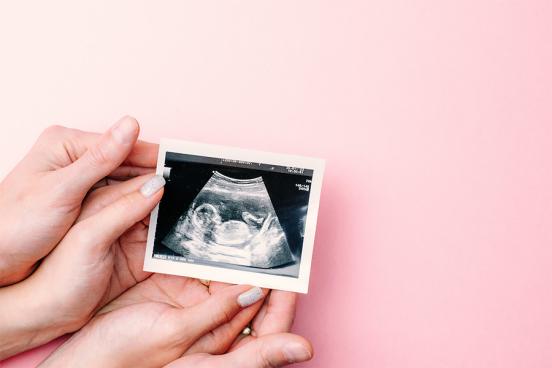 Two pairs of hands holding an ultrasound photo of a baby