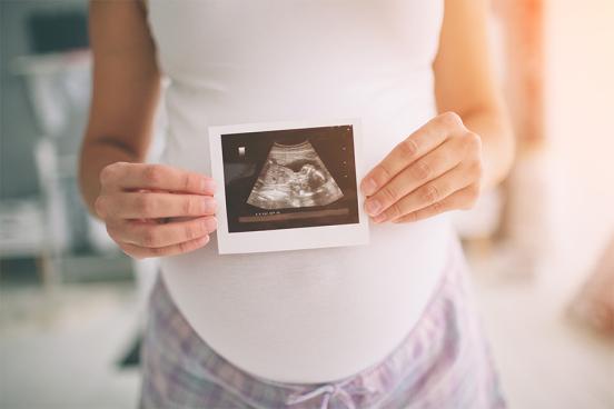 Pregnant woman holding an ultrasound photo