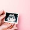 Two pairs of hands holding an ultrasound photo of a baby