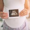 Pregnant woman holding an ultrasound photo